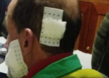 اعتداء على عامل نظافة بتطوان… توقيف المشتبه فيه بسرعة قياسية